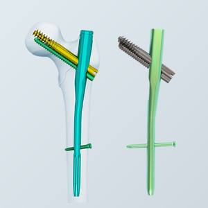 Titanium Intertan Interlocking Intramedullary Nail Implant For Orthopedic Fracture Trauma Treatment