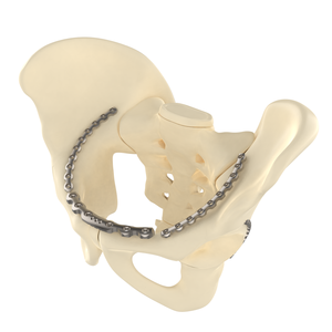 CANWELL CE/ISO Certified Stainless Steel Orthopedic Trauma 3.5mm Pelvic Locking Plate Curved Bone Fixation Implant Anatomical