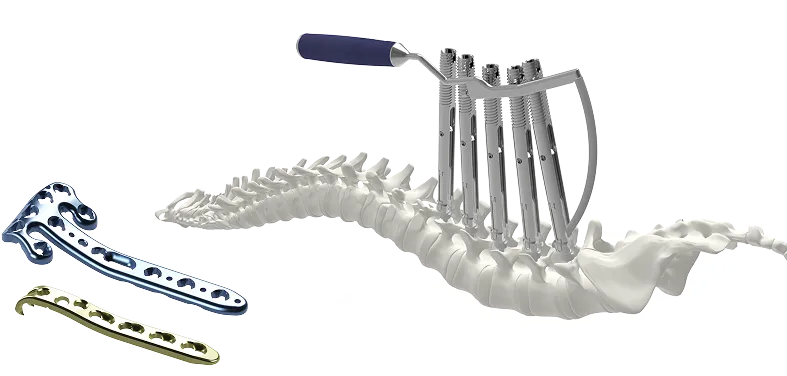 Reliable orthopedic implants supplier - 3D spine model