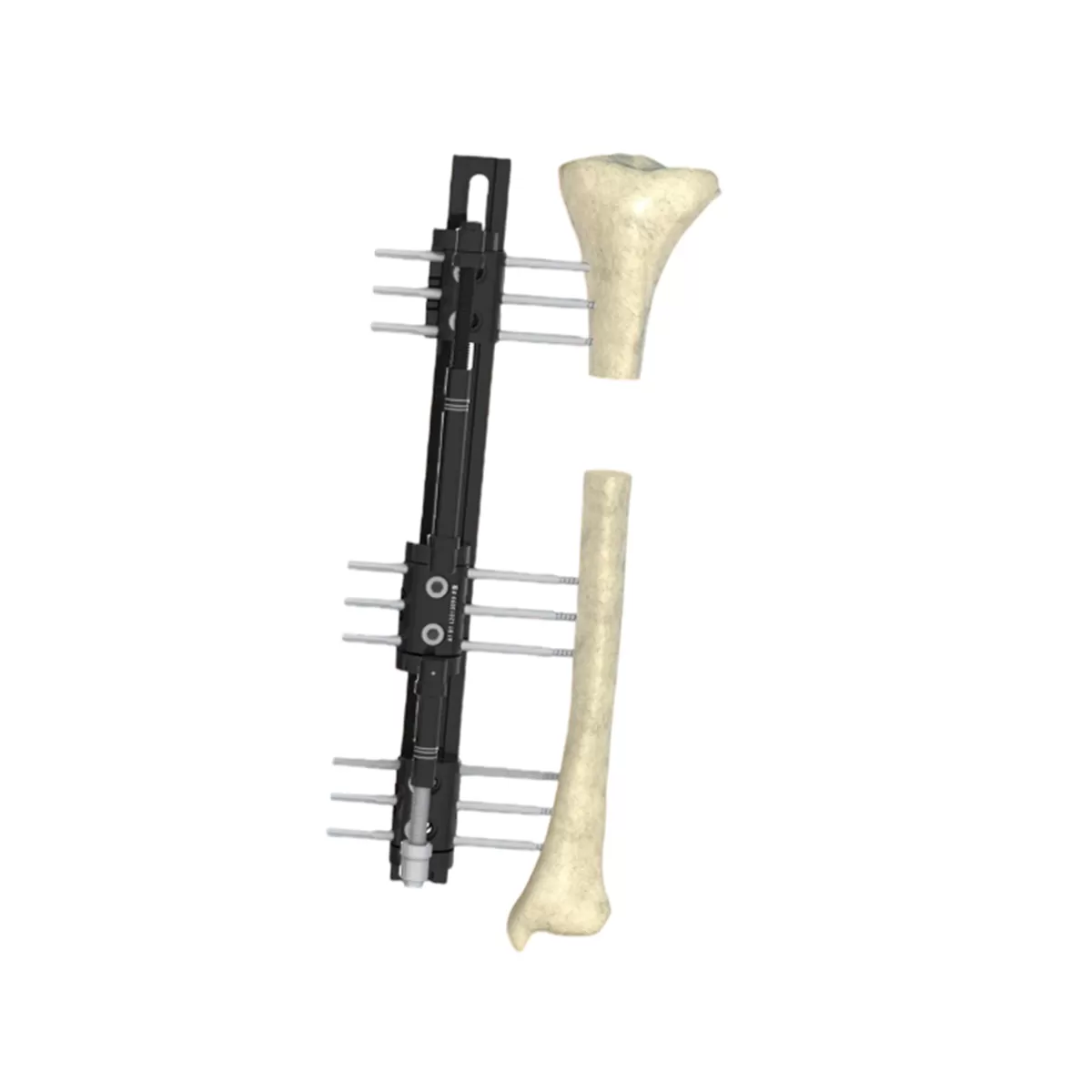 R-Type Combination External Fixator System