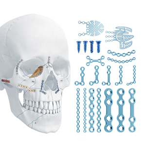 Titanium Maxillofacial Plate And Screw System