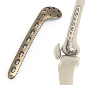 CANWELL Titanium Distal Medial Femoral Locking Plate Orthopedic Implant Factory Trauma Broken Bone Fracture Surgery CE OEM