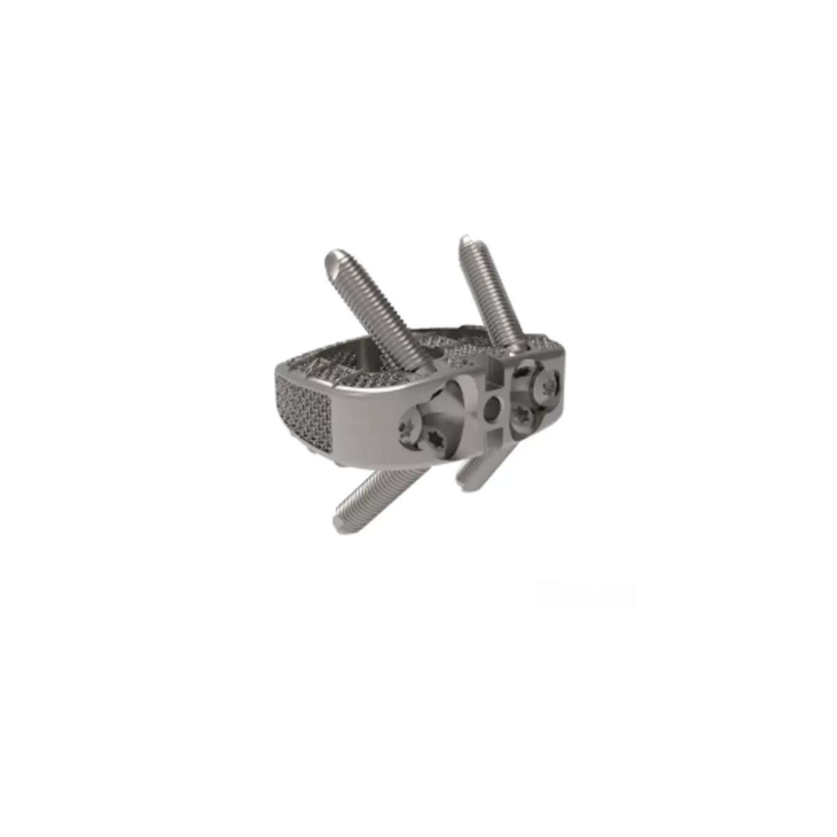 3D Printed Titanium ALIF Cage System