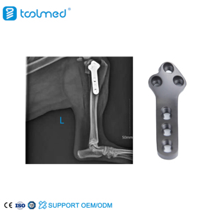 TOOLMED Orthopedic TPLO 3.5 II Titanium Plate
