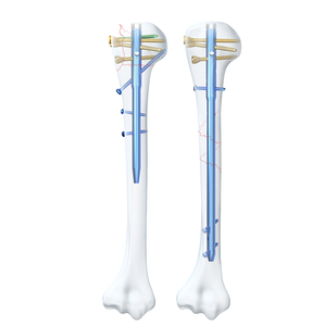 Orthopedic Surgical Humeral Nail