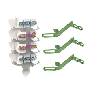 Medical High Quality CE/ISO Certified Orthopedic Implants Pure Titanium Double-Bend Long-Hole Locking